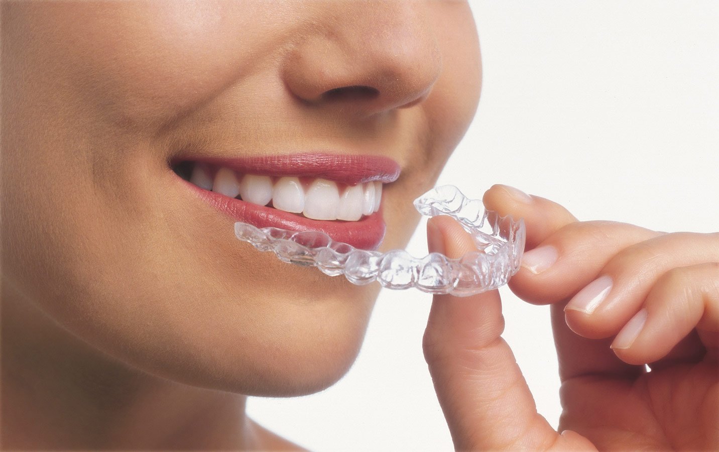 Invisalign® / Clear Aligners